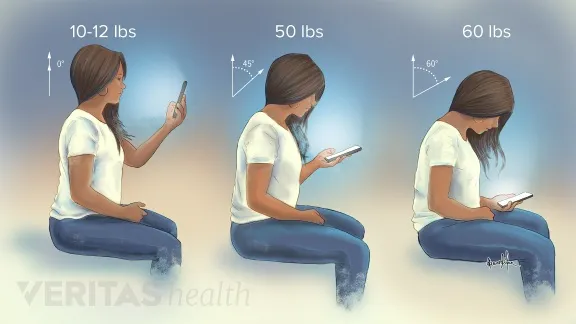 Understanding Neck Pain: Causes, Posture, and Spine Health